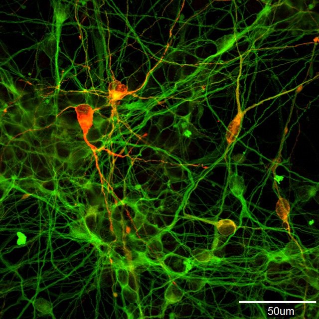 Neuronas fabricantes de dopamina inducidas, creadas a partir de células iPS humanas. (Fotografía de Morizane Asuka, del Laboratorio de Investigación de Células iPS de la Universidad de Kioto)
