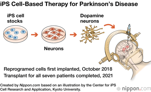 iPS Cell-Based Therapy for Parkinson’s Disease