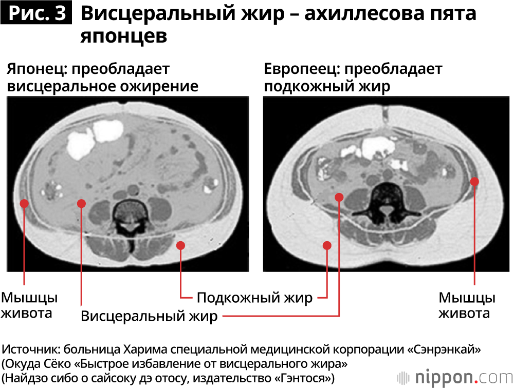 КТ брюшной полости