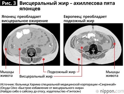 КТ брюшной полости