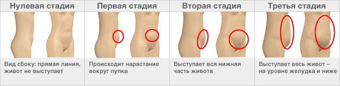 【Возрастные изменения формы бедер и живота】У разных людей изменения начинаются в разном возрасте; некоторые женщины и на пятом десятке находятся на нулевой стадии.