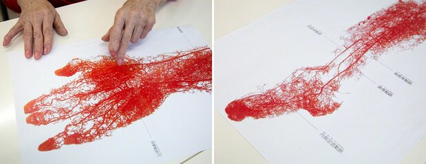 Comme la frondaison d’un arbre, les vaisseaux sanguins de la main et du pied s’étendent et se ramifient jusqu’à l’extrémité des membres.
