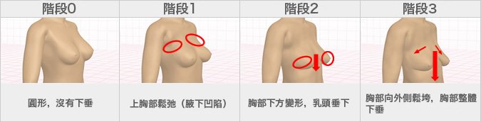 【隨年齡成長而變化的胸部形狀】胸部下垂從20歲開始，有人在20歲至30歲之間就進入第2階段