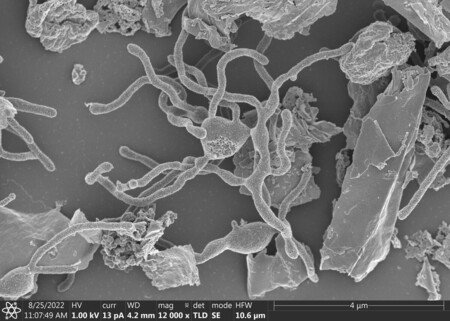 An image of an archaeon (center) in a strain closely related to eukaryotes, with multiple protrusions extending from the body, taken by a scanning electron microscope (Courtesy of JAMSTEC)