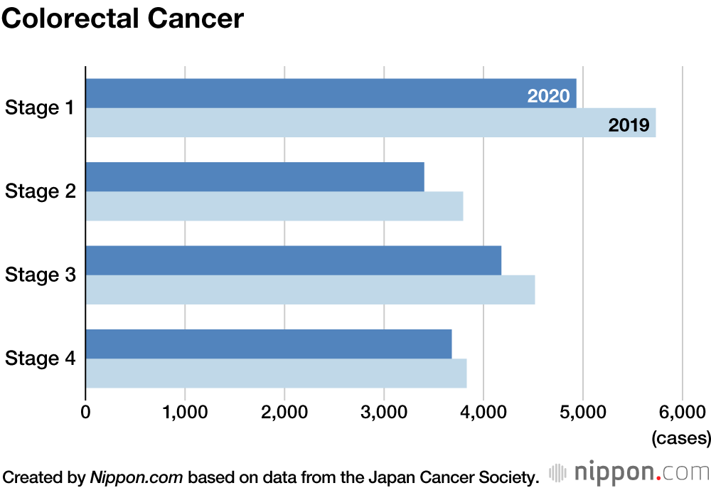 Delayed Checkups Seen as Cause of Japan’s Reduced Cancer Diagnoses in 2020