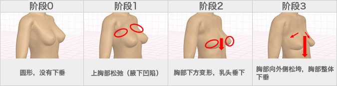 【随年龄增长而变化的胸部形状】胸部下垂从20岁开始，有人在20岁至30岁之间就进入第2阶段