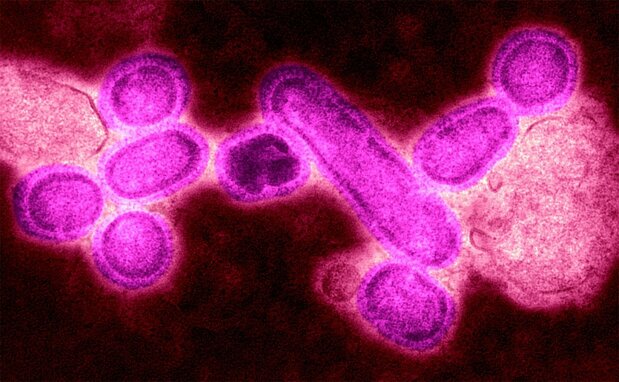 スペイン風邪を引き起こしたインフルエンザA H1N1ウイルスの電子顕微鏡写真。2005年、米国国立感染症センター(CDC)のテレンス・タンペイは、人間から感染する鳥インフルエンザからこのウイルスを再構築することに成功した(Photo By BSIP/UIG Via Getty Images)