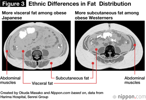 Cross-sections showing the distribution of abdominal fat in representative Japanese (left) and Westerners (right) subjects.