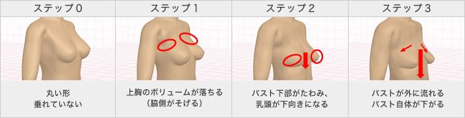 【加齢によるバストの形の変化】20代からバストの下垂は始まり、20代でステップ2の人もいる。