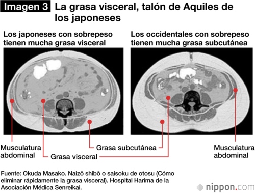 Sección transversal del abdomen, con el ombligo arriba y la espalda abajo.