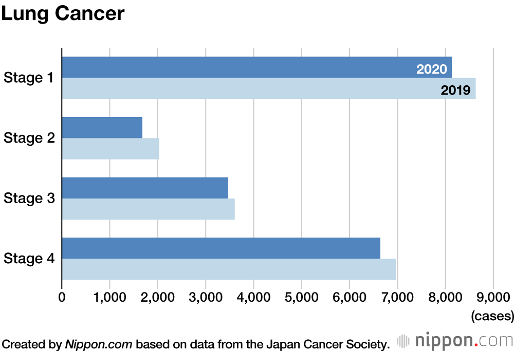 Delayed Checkups Seen as Cause of Japan’s Reduced Cancer Diagnoses in 2020