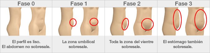 El cambio de la forma de la cadera con la edad: la edad de inicio del proceso varía entre personas, y hay mujeres de entre 40 y 49 años que se mantienen en la fase 0.