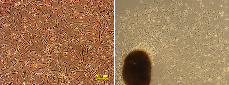 Des cellules cultivées à partir de la peau d’animaux appartenant à des espèces menacées d’extinction — à droite : râle d’Okinawa ; à gauche ibis à crête (avec l’aimable autorisation de l’Institut national pour les études environnementales).