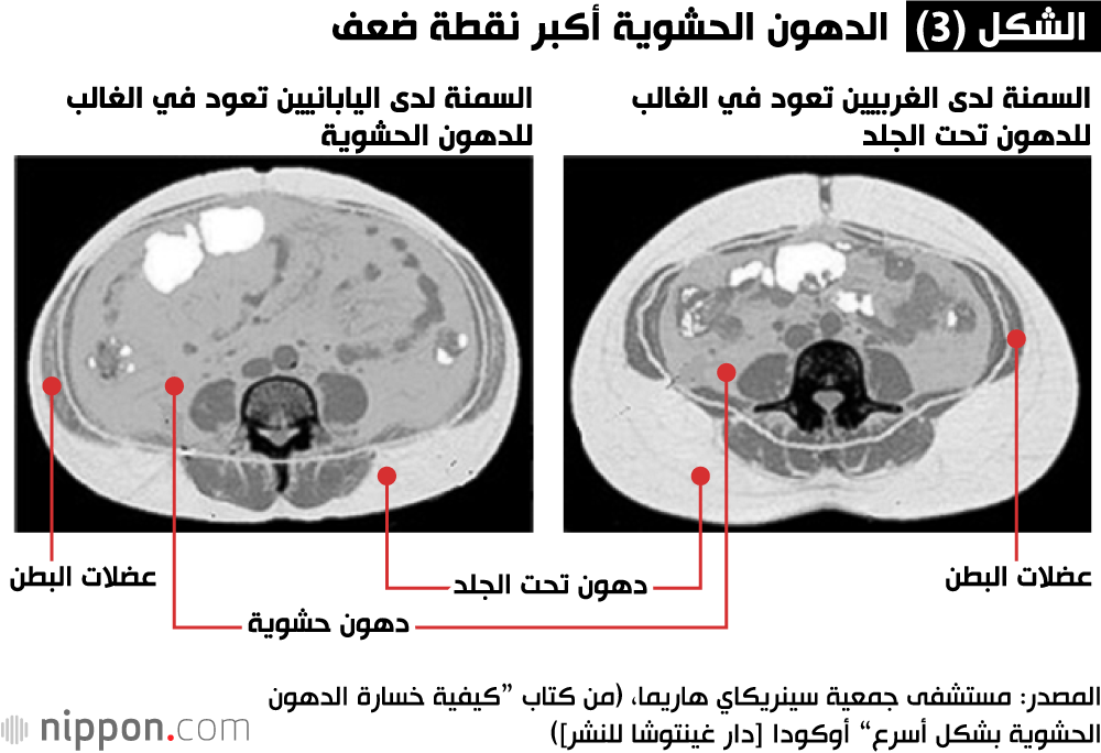 صورة مقطع عرضي للبطن. السرة في الأعلى، والظهر في الأسفل.