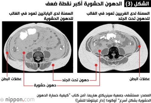 صورة مقطع عرضي للبطن. السرة في الأعلى، والظهر في الأسفل.