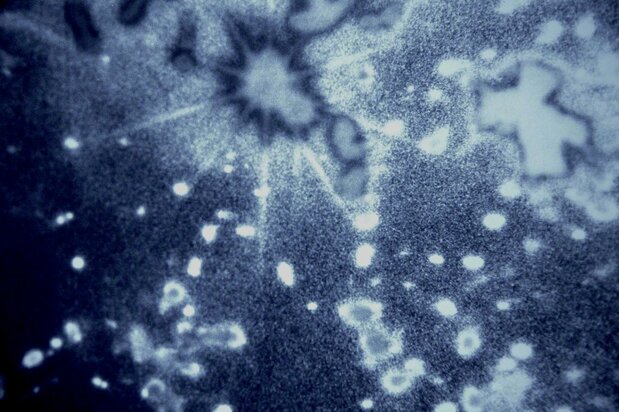 Si miras fijamente el sol que se cuela entre las ramas de los árboles, sientes como si te teletransportases al momento en que se creó el universo.