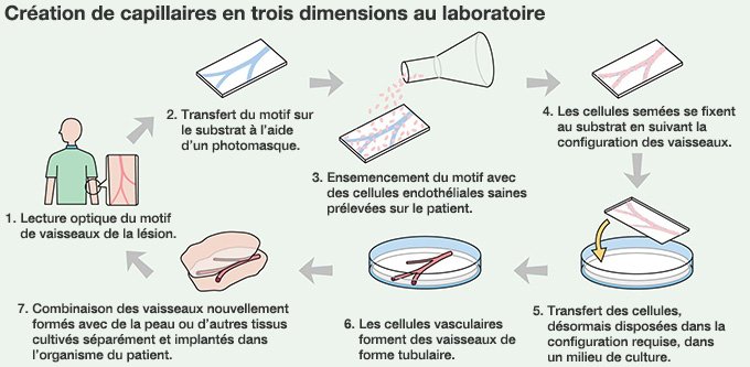 Une imprimerie se lance dans la médecine régénératrice