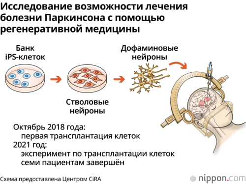 Исследование возможности лечения болезни Паркинсона с помощью регенеративной медицины