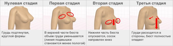【Возрастные изменения формы груди】 Начиная с 20 лет бюст постепенно опускается, у некоторых женщин вторая стадия начинается уже на третьем десятке.