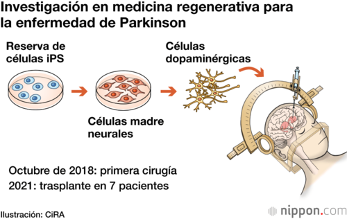 Investigación en medicina regenerativa para la enfermedad de Parkinson