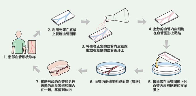 立体毛细血管的再造过程
