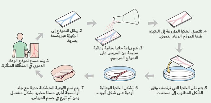 تخليق أوعية شعرية ثلاثية الأبعاد مخبريا.