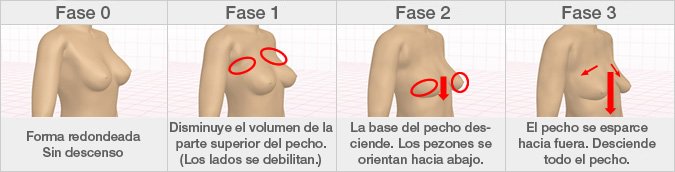 El cambio de la forma del pecho con la edad: entre los 20 y los 29 años el pecho empieza a caer y algunas mujeres entran en la segunda fase.