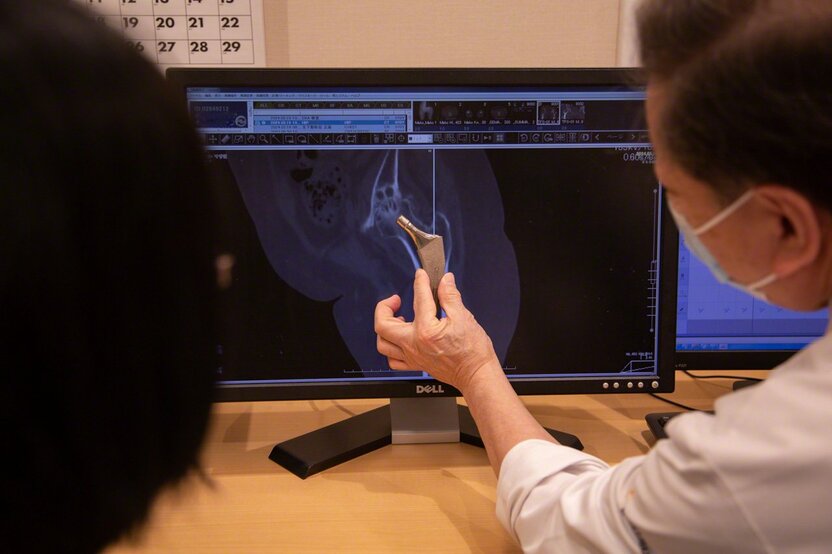 “This is how we’ll insert the hip implant,” explains Dr. Matsubara. He spares no time or effort ensuring that each patient understands the procedure and is comfortable with it. (© Ōnishi Naruaki)