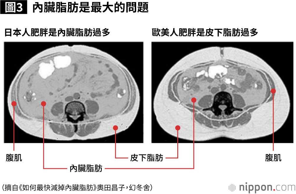 腹部的橫斷面照片。上為肚臍，下為後背。