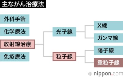 主ながん治療法