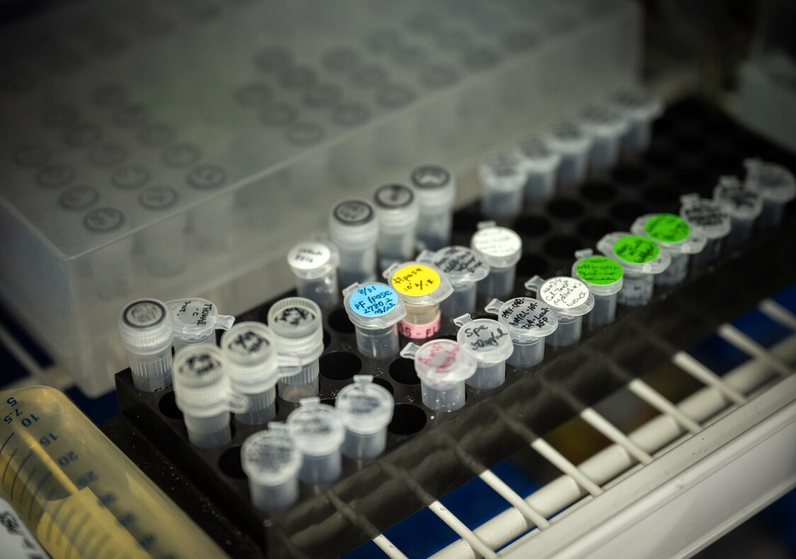Les cellules iPS, une avancée à double tranchant : entre promesse de rajeunissement et risques de cancer