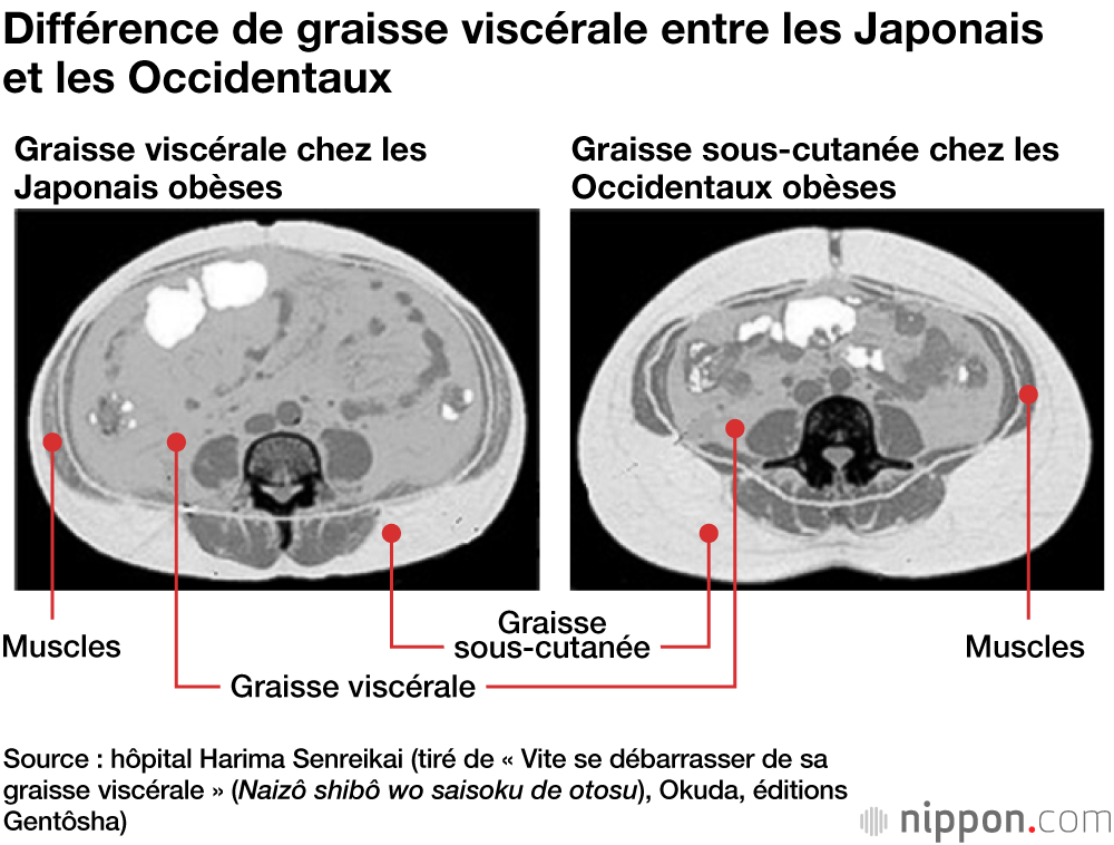 Vue en coupe de l’abdomen (nombril en haut et fesses en bas)
